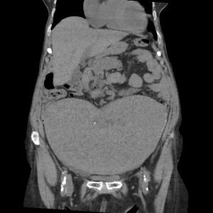 23458376dcdea6c43f0b52237ee91a_big_gallery