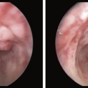 3-s2.0-B9780128024065000070-f07-13-9780128024065