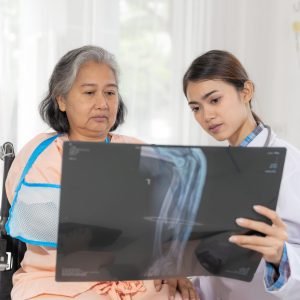 Doctor Inform health examination results of  X-ray Film to encourage senior elderly woman Broken arm patients in the hospital- medical senior concept