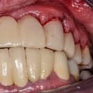 download - 2025-08-27T151421.529