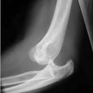 download - 2025-08-28T000406.364